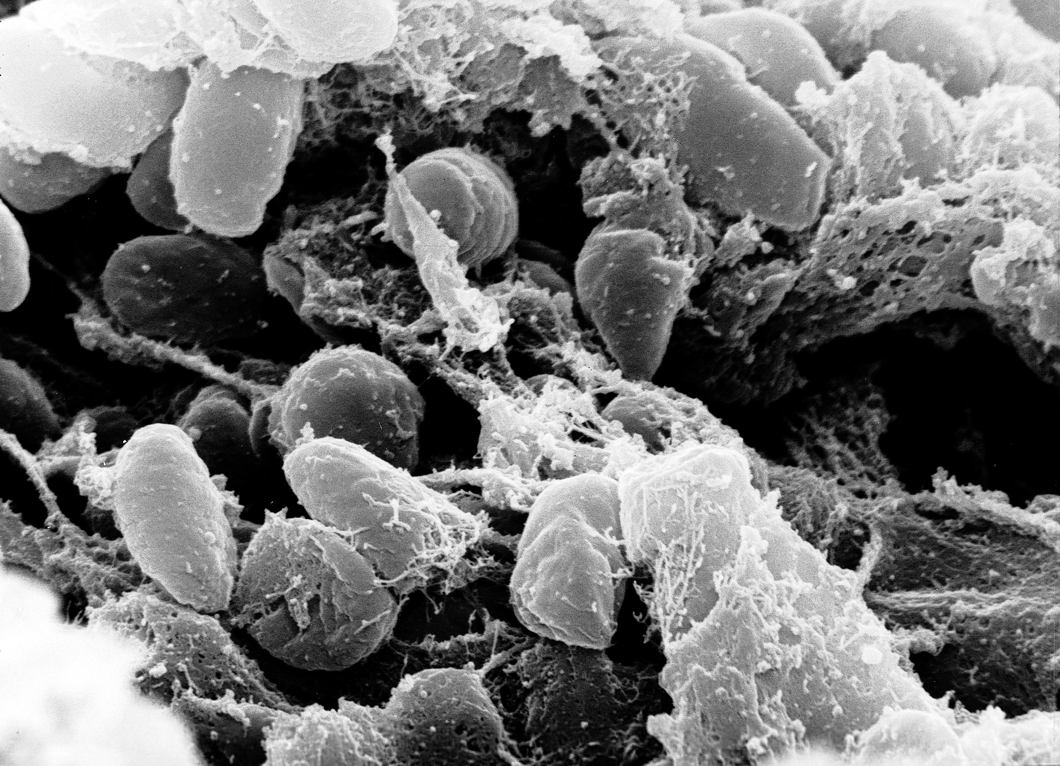 Yersina Pestis (Black Death)